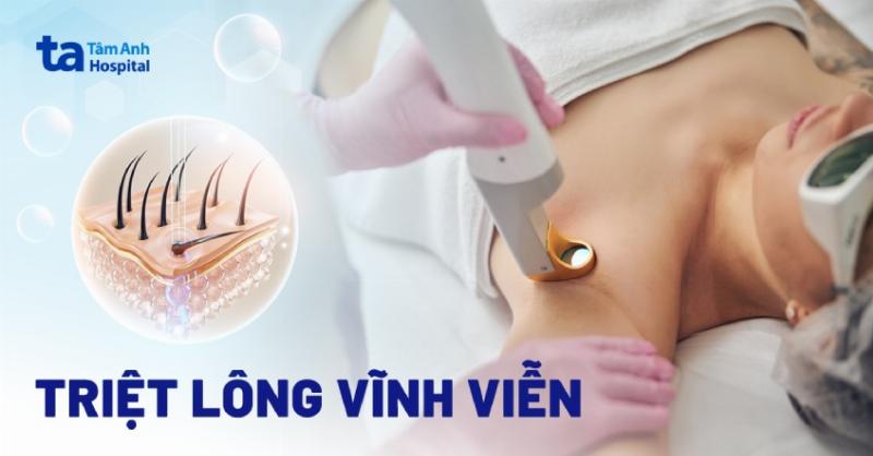 Kem triệt lông vĩnh viễn hiệu quả