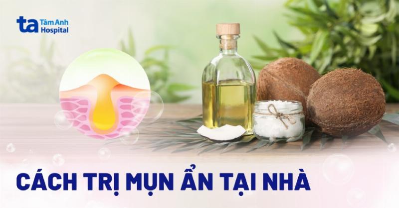 Mẹo chăm sóc da mụn ẩn tại nhà