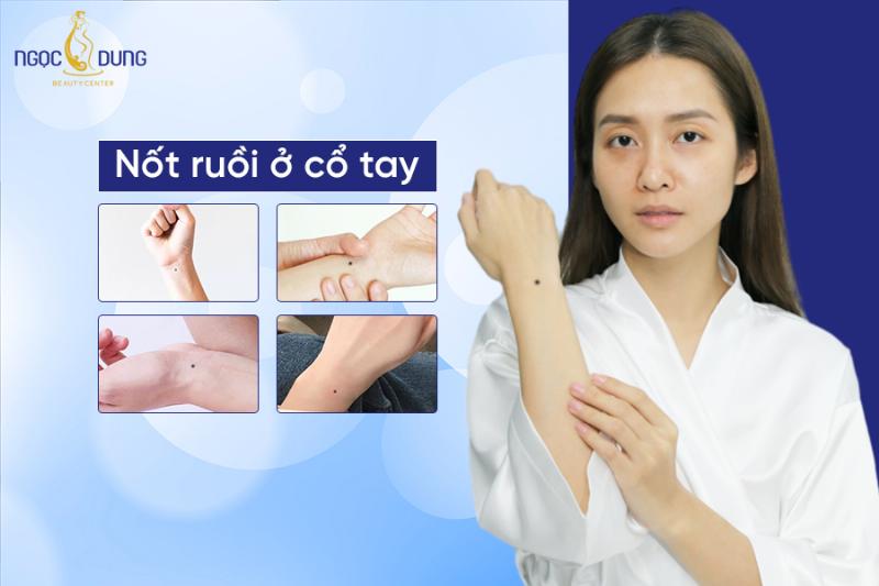 Nốt ruồi cổ tay trái nữ và sự nghiệp