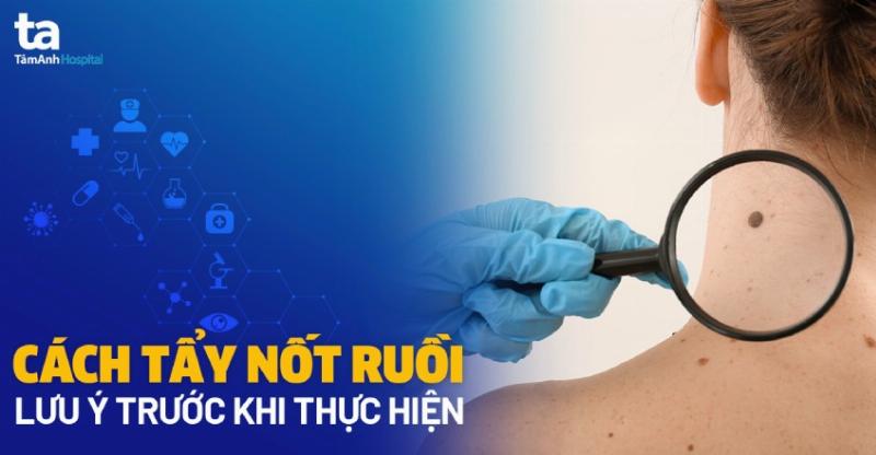 Nốt ruồi cổ tay trái nữ: Xem bói và lời khuyên chuyên gia