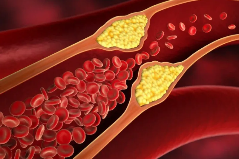 Thực đơn ăn dặm chay cho bé giúp giảm nồng độ cholesterol